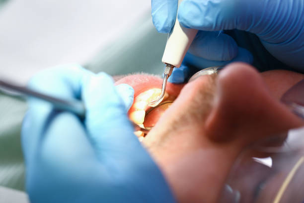 Best Emergency Dental Care for Broken or Chipped Teeth in Yakima, WA