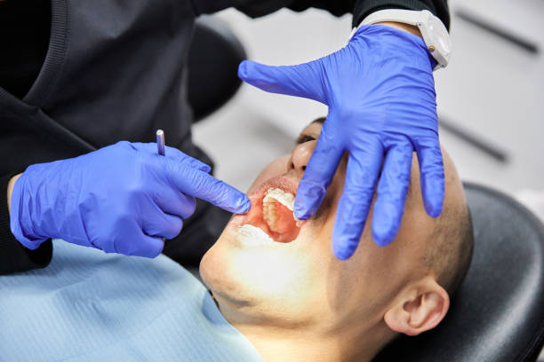 Best Emergency Treatment for Dental Infections or Abscesses in Yakima, WA